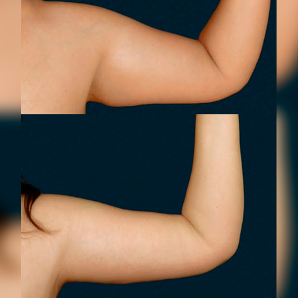 Фото отзыва